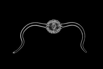 Radiolarian - Stylosphaera flexuosa - image #453471 gratis