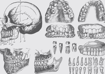 Dental Disease Illustrations - Free vector #401391